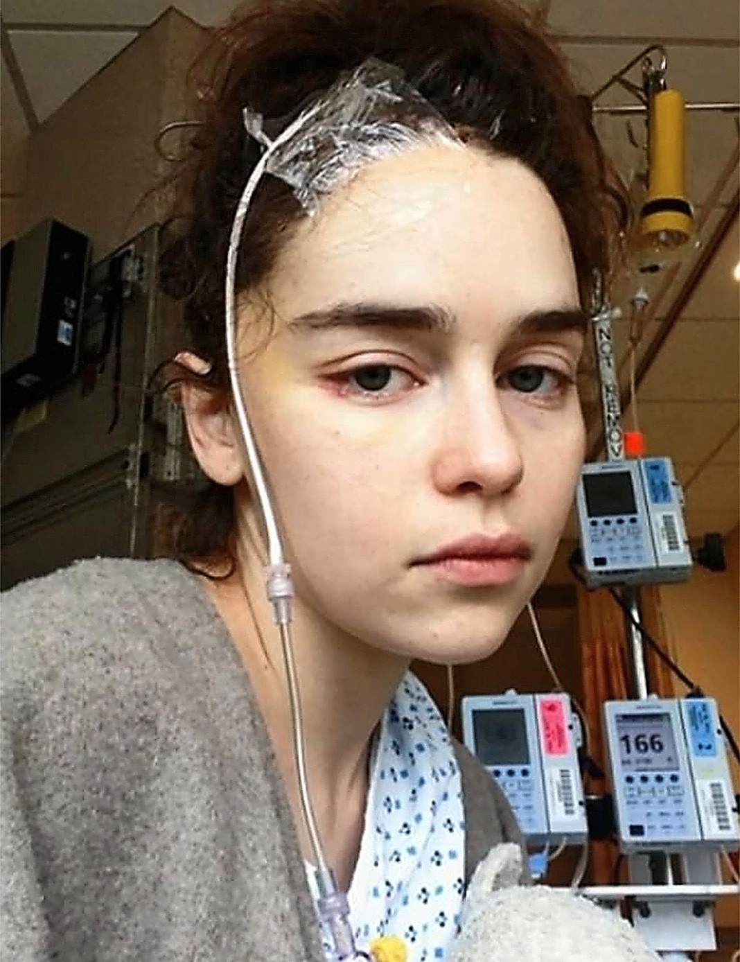 Эмилия Кларк фото из больницы после инсульта