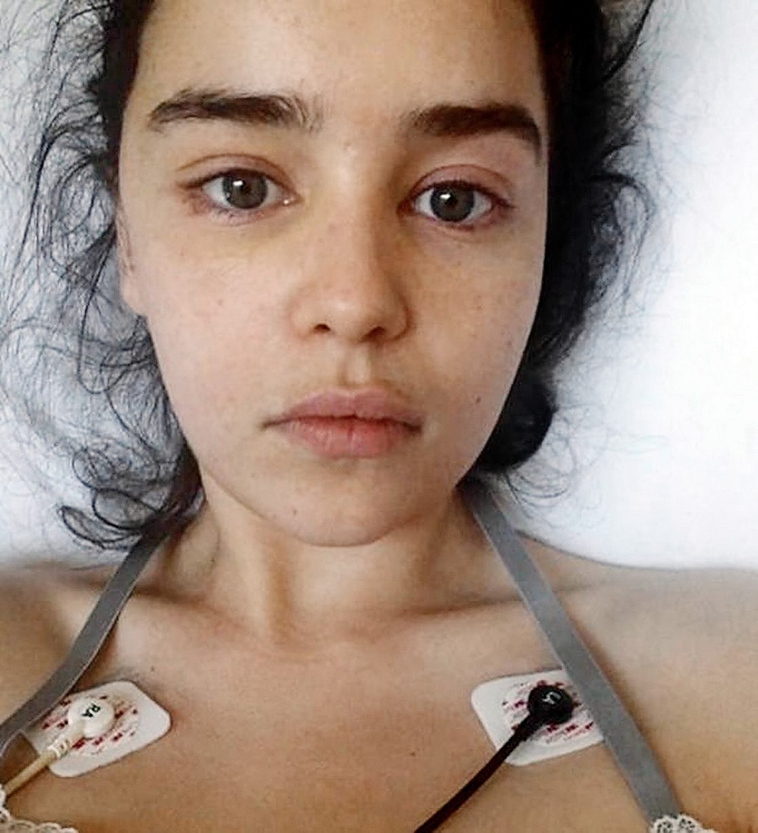 Эмилия Кларк в больнице после инсульта
